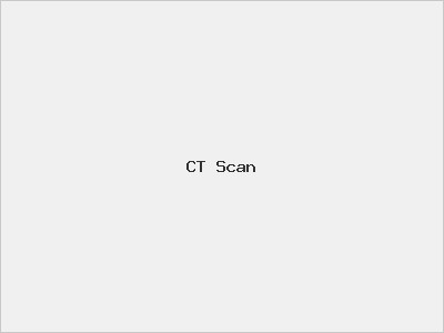 CT Scan